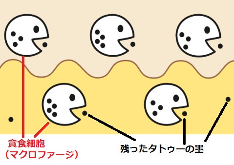 貪食細胞(マクロファージ)