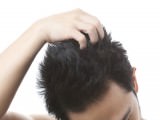 かゆみをともなう頭皮湿疹の原因とセルフケア・皮膚科での治療