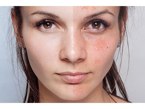 茶色っぽいくすみの原因と改善方法