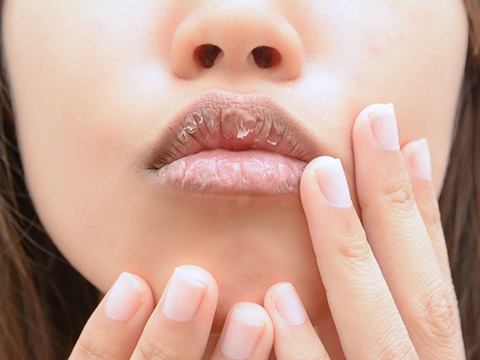 唇がカサカサ乾燥で痛くなる原因と治し方 効果のある美容アイテムも紹介 スキンケア大学