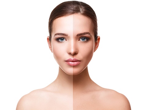 ハイドロキノンの使用期間は3か月までが目安