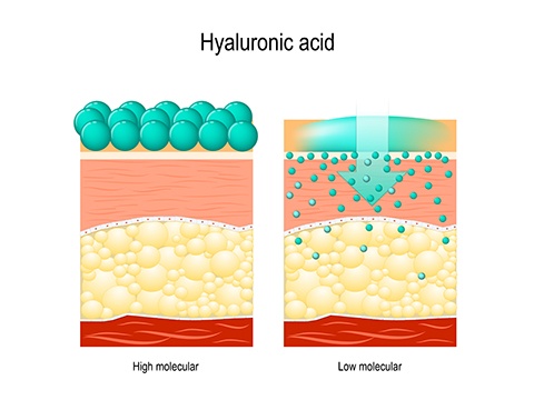 化粧品と注射ではアプローチが異なるヒアルロン酸