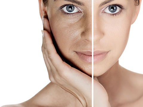 目立つ毛穴が美肌の妨げに