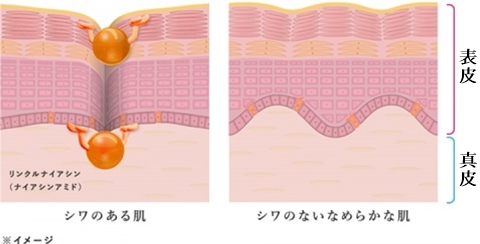 リンクルナイアシンが表皮と真皮のシワを改善するイメージ図