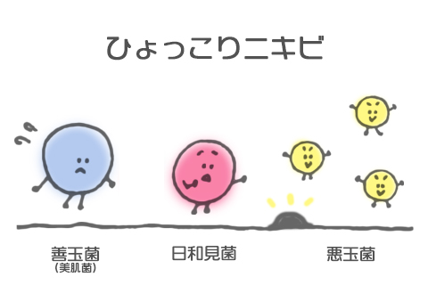 ひょっこりニキビ