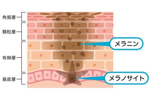 メラノサイトでシミができる図解
