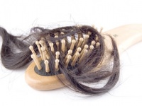 女性の円形脱毛症の原因とは？症状の特徴と対処・治療法