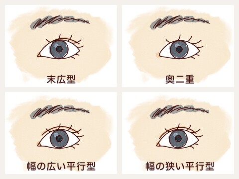 二重まぶた図:末広型の二重・奥二重・幅の広い平行型の二重・幅の狭い平行型の二重