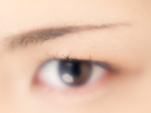 眼瞼下垂症になる原因と手術での治し方