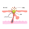毛穴についての解説